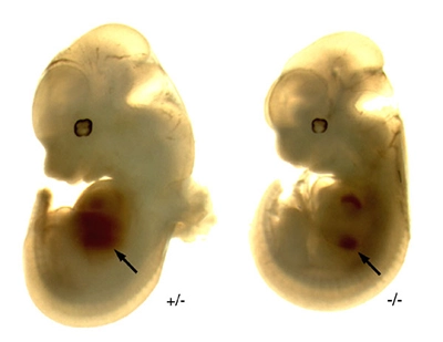 胎生期11.5日の Hex ノックアウトマウス（右）と野生型マウス（左）